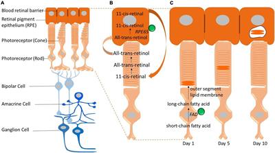 Effects of Excess Iron on the Retina: Insights From Clinical Cases and Animal Models of Iron Disorders